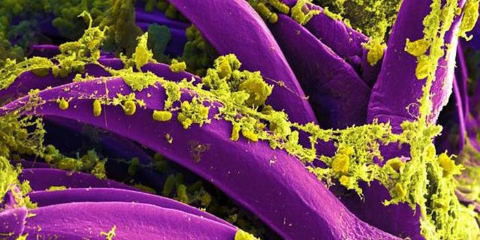 Over Time, Plague Infections Spread Faster