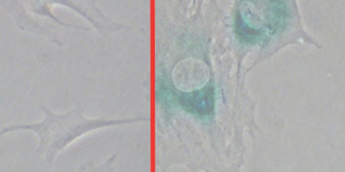 Killing Zombie Cells to Stay Youthful