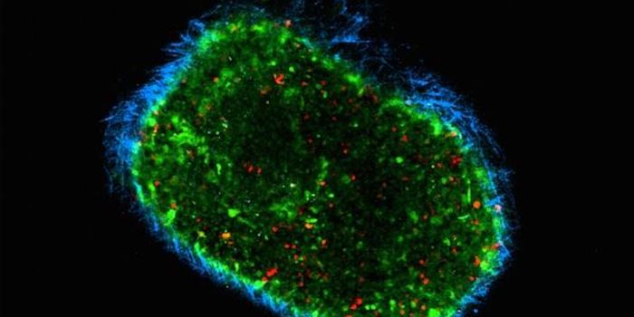 On-the-Go T Cells Better Equipped to Kill Tumor Cells