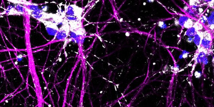 CRISPR Reveals Mitochondrial Dysfunction Underlying ALS