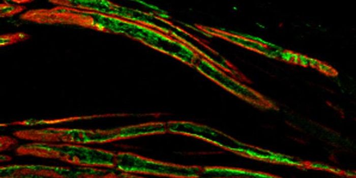 Researchers Find Potential new Treatment for Pain