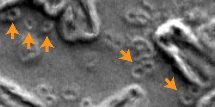 After Chromosomes Shatter, Cancer Cells Can Become Drug-Resistant