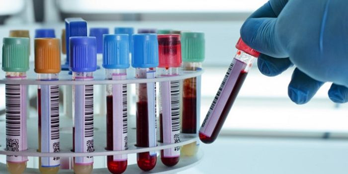 An Inhibitory Compound 'ITI-214' Shows Promising Effects for Heart Failure Patients