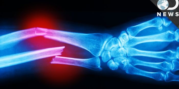 What Does it Take to Break a Bone?