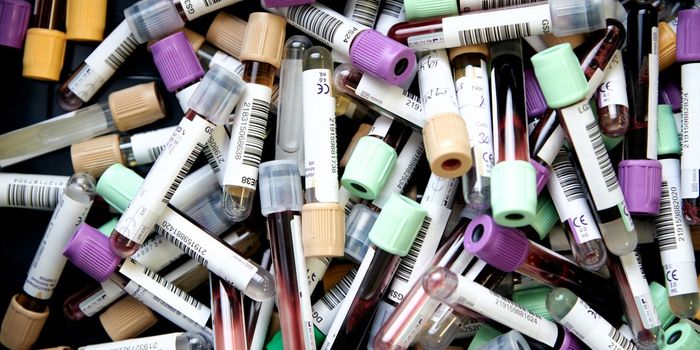 Computer Vision Technology Advances Glucose Meters