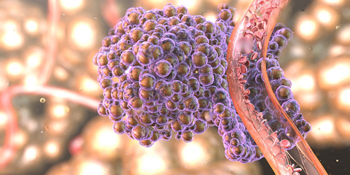 Genetic "Snitch" Uncovers Hiding Cancer Cells