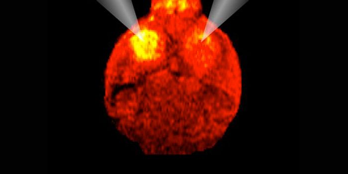 Method Created for Visualizing Gene Expression by MRI