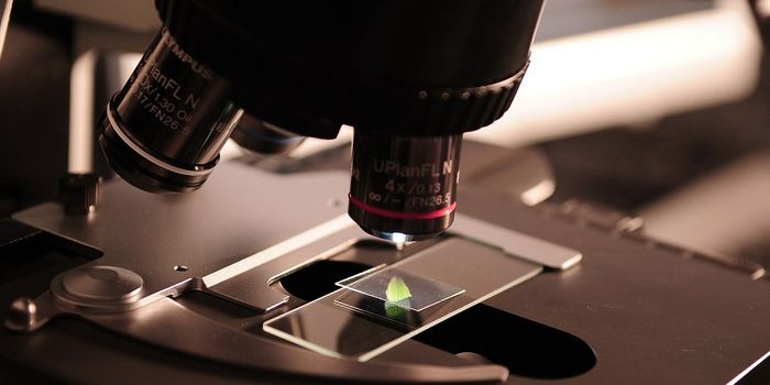 A New 3D Imaging Method for Atherosclerosis Analysis in Mice