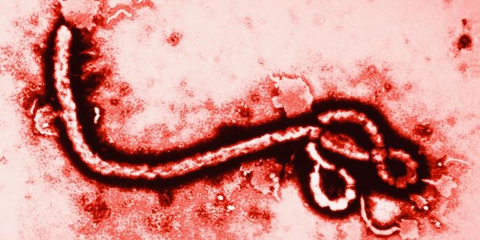 New Hybrid Chip to Diagnose Ebola