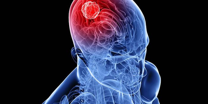 Personalized Cellular Therapy for Brain Cancer