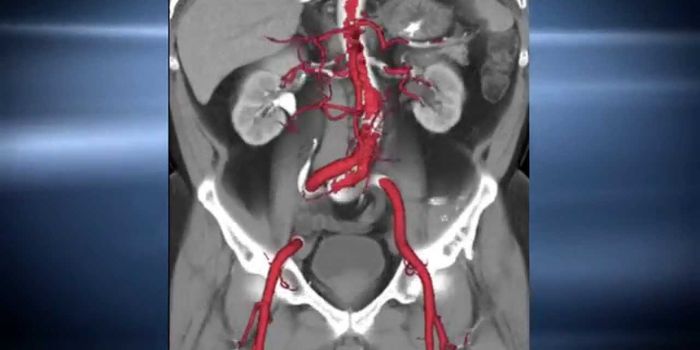 Brains, Veins and Bones Revealed With GE Scanner