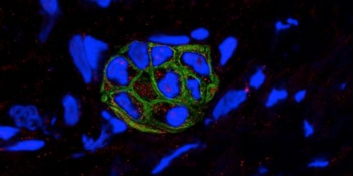 Pancreatic Tumors Spurred On By Cell Death
