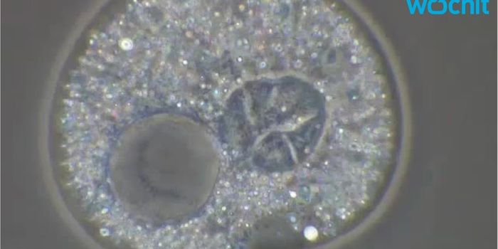 Amoeba Infection Kills Ohio Teenager