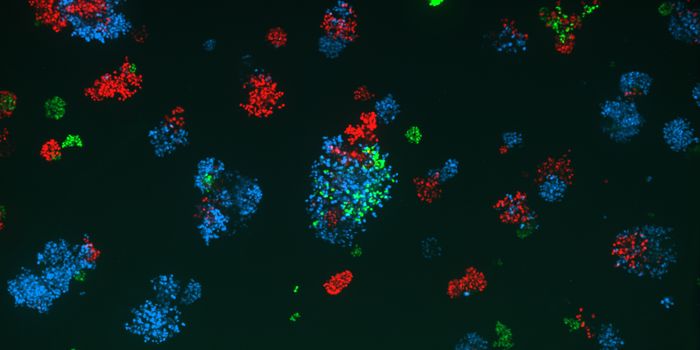 From Spheroids to Insights: The Game-Changing Power of Incucyte® CX3