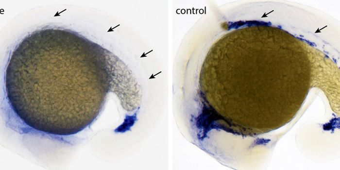 Search For Embryonic Blood Vessel Mutant Gene Finally Ends