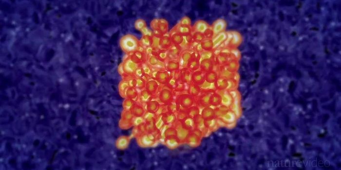 Immunotherapy: Boosting the immune system to fight cancer 