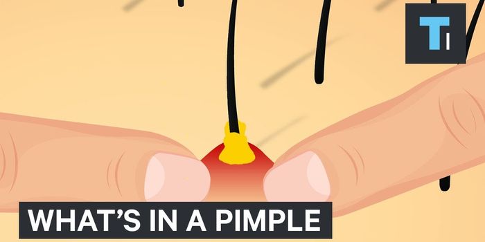 Here's What's Inside of a Pimple