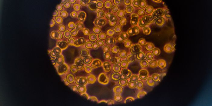 Immune-Brain Connection in Rare Disease Puzzles Scientists