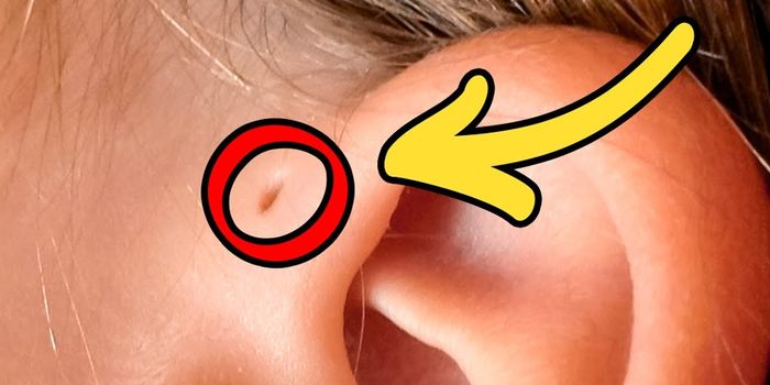 Weird body anomalies only 5% of people have