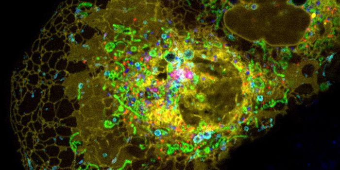 What's In a Lysosome?