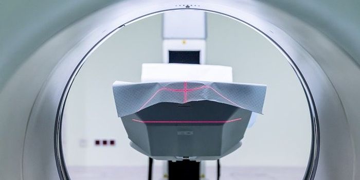 New Portable MRI Swoops Into Hospital Rooms, Gets FDA Nod