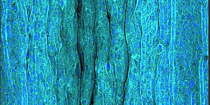 A New Wrinkle Research Model Reveals More About How They Form