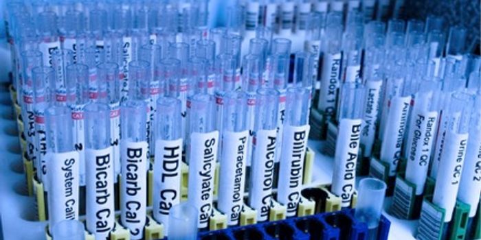 Study Reveals Doctors Order Lab Tests in Excess