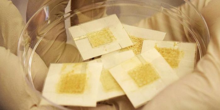 A Microbrewery can Help us Monitor Radiation Exposure