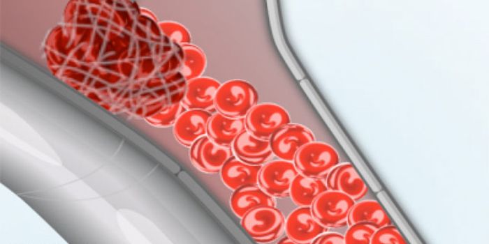Arterial Thrombus Formation Modeled by Biophysicists