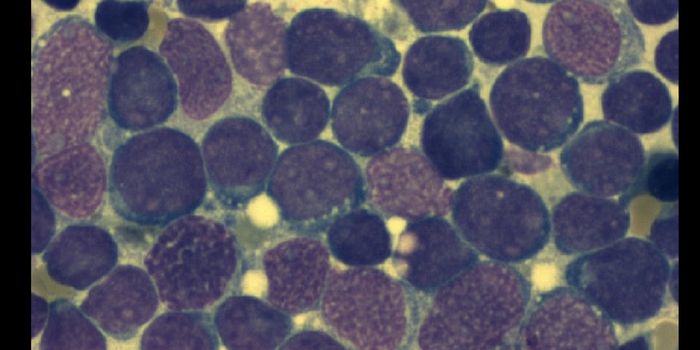 Breakthrough Analysis Outlines Conceivable Cause of Childhood ALL