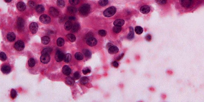 Changes In tRNA Levels Shown to Drive Cancer Metastasis