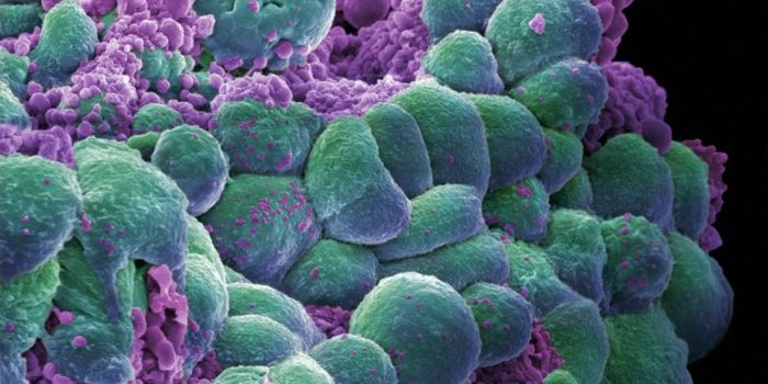 Human Breast Cancer Linked to Leukemia Virus in Cattle