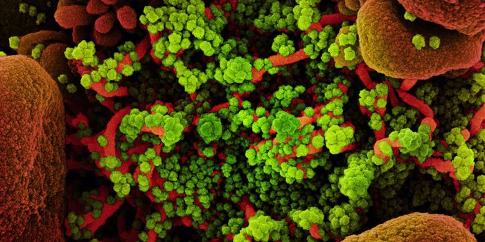 Is a Venom-Like Molecule Involved in COVID-19 Mortality?