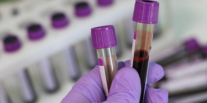 Blood test to predict prostate cancer