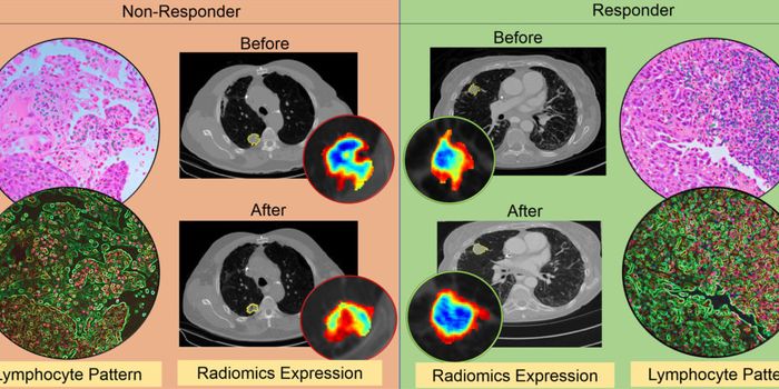 How artificial intelligence (AI) is improving immunotherapy
