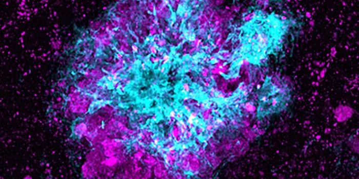 Fixing the Garbage Disposal