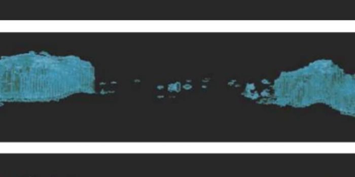 A Surprising Culprit Behind Multiple Sclerosis