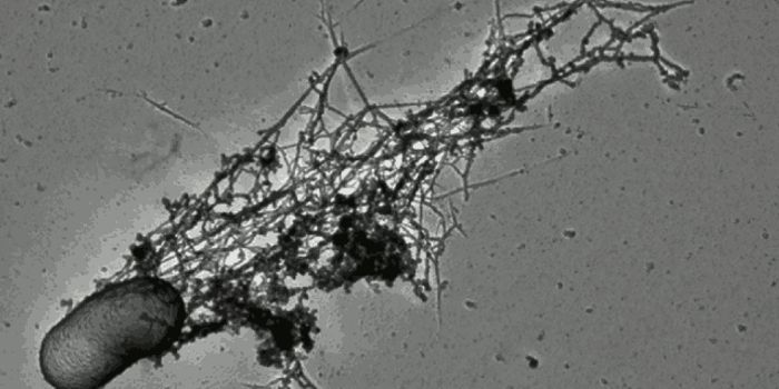 Better Know a Microbe: Listeria