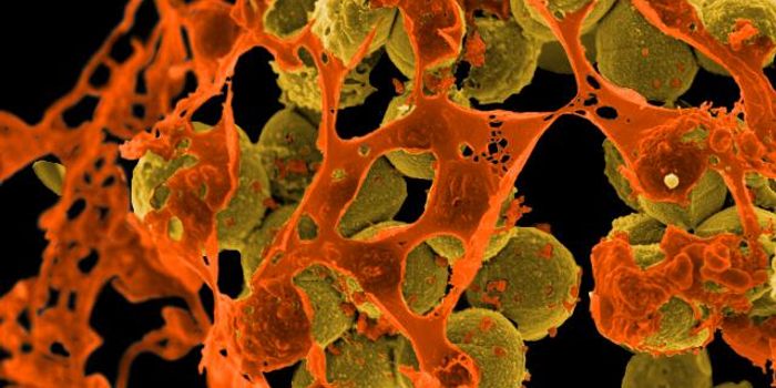 We're Running Out of Ways to Treat Staph Infections