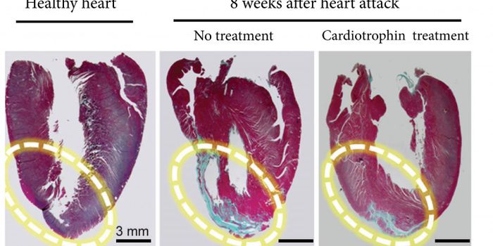 Heart Protein Makes the Heart Think You're Exercising When You're Not