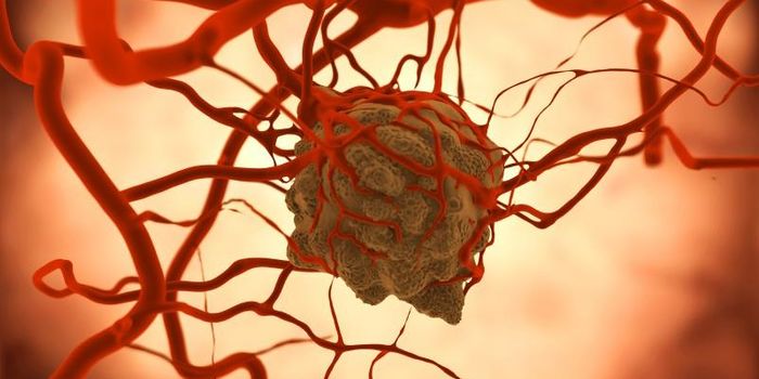 How Cancer Spreads Even Before a Tumor Develops