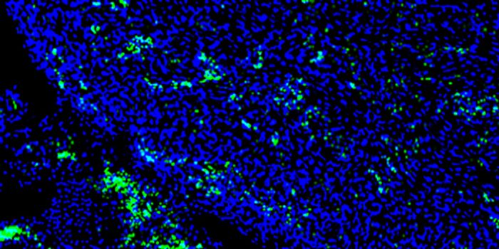 Chimera Advancements Boost Biomedical Therapy & Research
