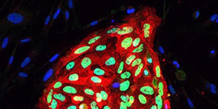 Potential Drug Target Found to Prevent Bowel Cancer Spread