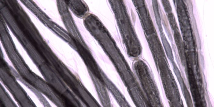 Immune-Mediated Neuropathies Caused By Autoantibodies