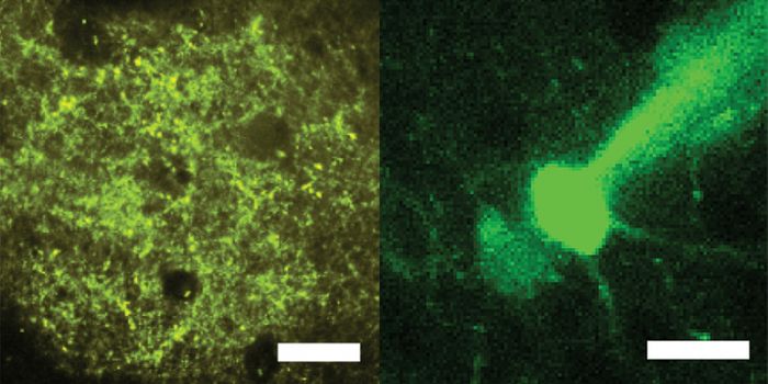 Researchers ID Brain Mechanisms Underlying Alertness and Attentiveness