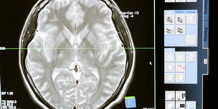 Anti-inflammatory Drug Candidate Prevents Cognitive Decline in Alzheimer's