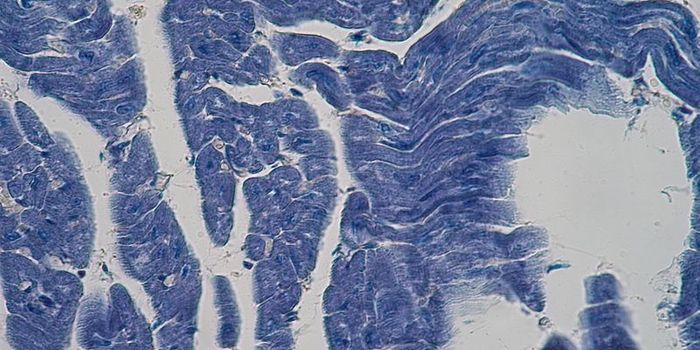 Heart Cells Sense Tension and Contraction in Heart Disease