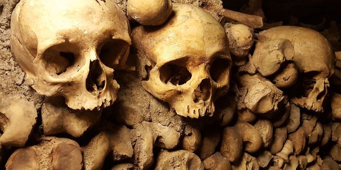 Drug for Osteoporosis Linked to Increased Risk of Adverse Cardiovascular Events