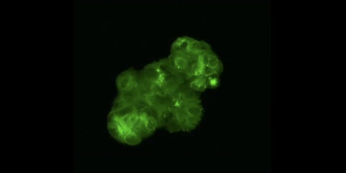 New CRISPR-HOT Technique Can Color Cells and Genes