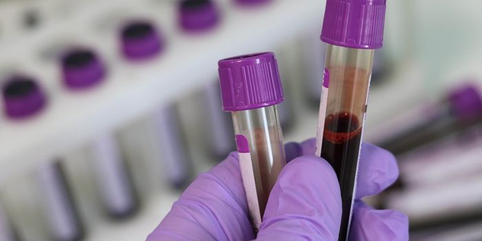 A Blood Test That Helps Identify Bipolar Disorder